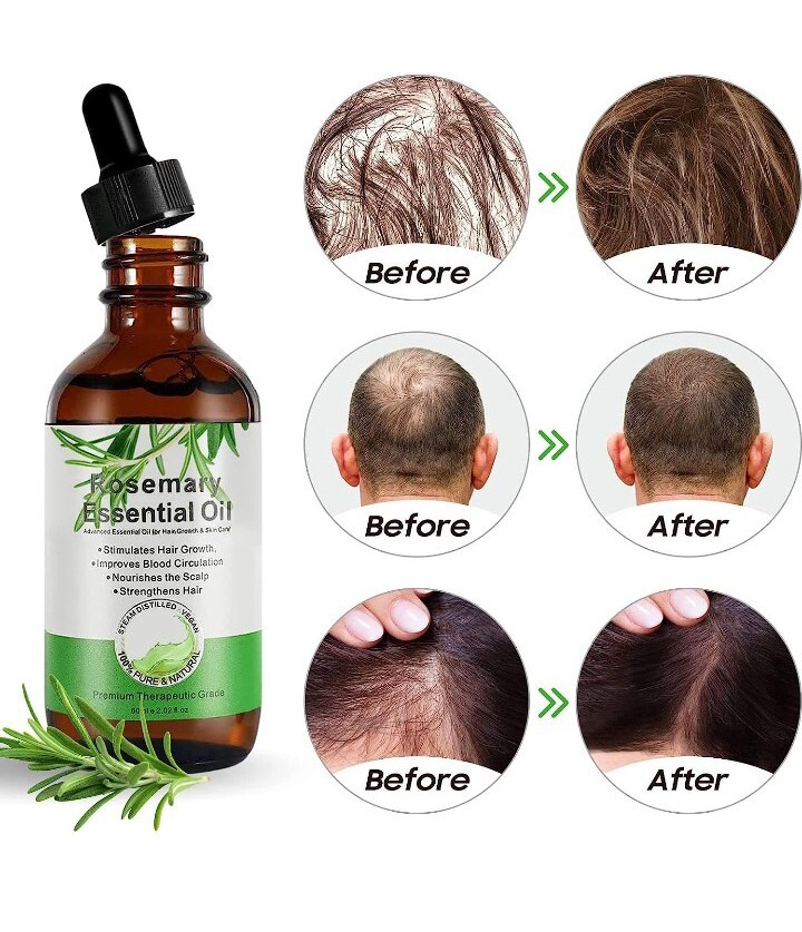 Olio di Rosmarino 60ml: Trattamento Naturale Anticaduta e Ricrescita