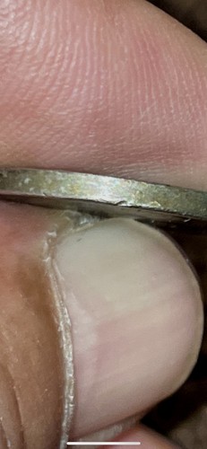 1999 Unsachgemäß geglühtes Nickel