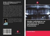 Ashank Mishra | Ajudas RadiolóGicas Na AvaliaçãO De DoençAs Periodontais E...