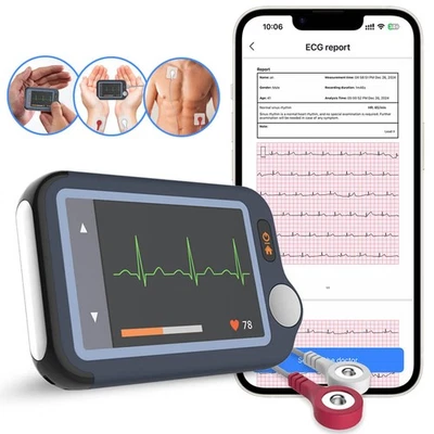 WELLUE Checkme EX Monitor de ECG portátil con aplicación Bluetooth y análisis de IA
