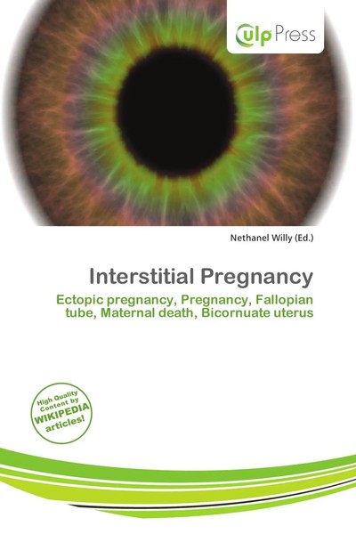 Nethanel Willy | Interstitial Pregnancy | Taschenbuch | Englisch (2026)-image