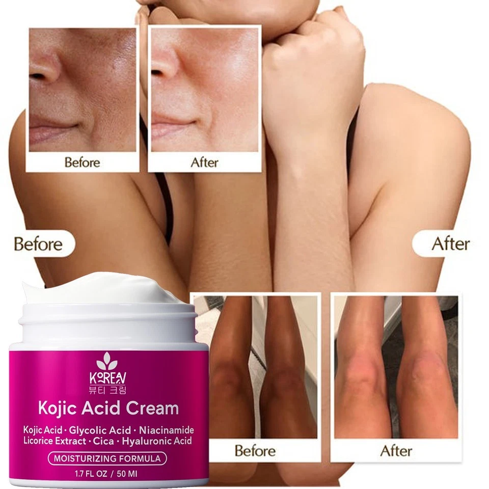 Korean Beauty Skincare Dark Spots Remover Cream Extra Strength, 1.7oz Per Unit. - Image 2 of 4