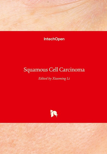 Squamous Cell Carcinoma Xiaoming Li-image