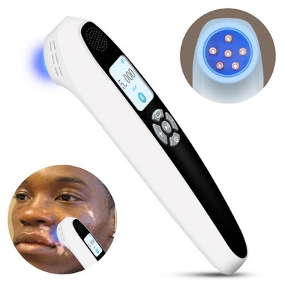 308nm Excimer UVB Light Treatment Device 6 Diodes 35mW for Foot Arm Skin Issues