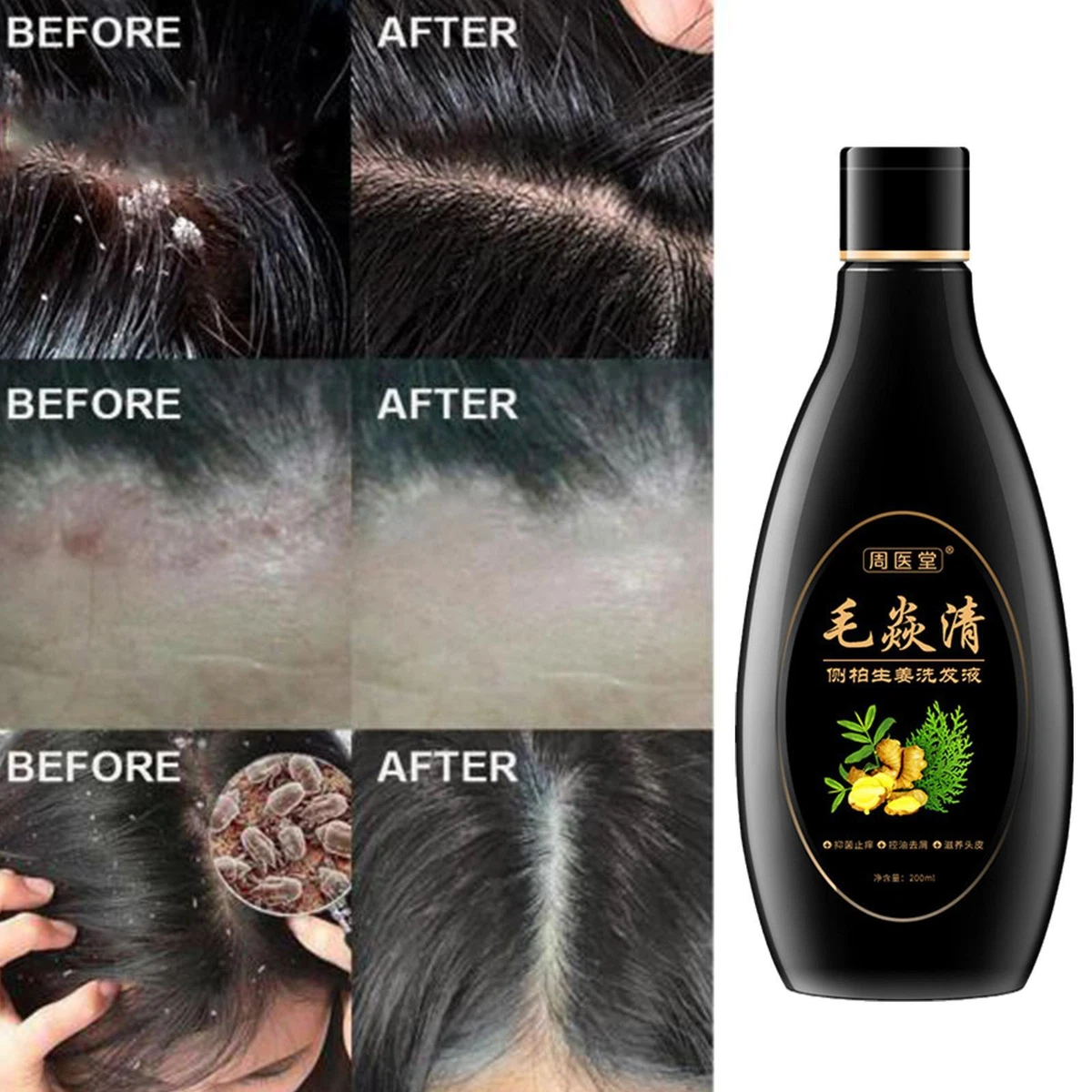 Antibacterial hair sales shampoo
