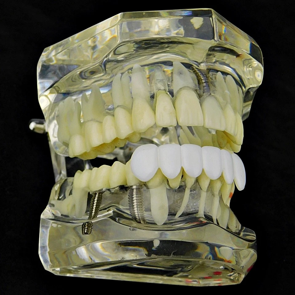 Pure White Teeth Grillz Bottom Teeth Six PC Hip Hop Mouth Grill Pre-Made Grills - Image 3 of 4