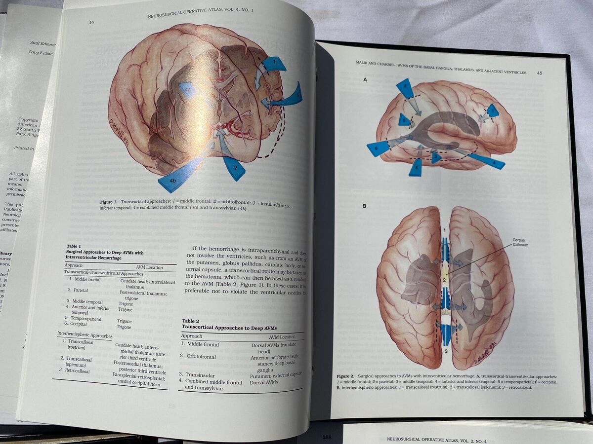 Neurosurgical Operative Atlas Vol.1-4 AANS Setti Rengachary Neurosurgical Operative Atlas Vol.1-4 AANS Setti Rengachary
