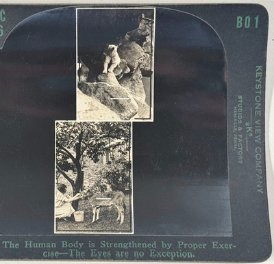 Fusing Upper Pics Requires 2 Prism Diopters; Changing Fixation Adds 8 Stereoview