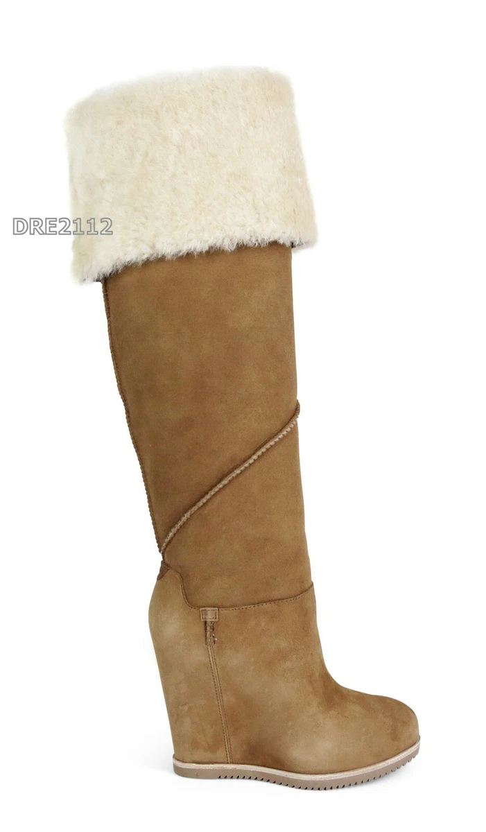 Otk uggs top