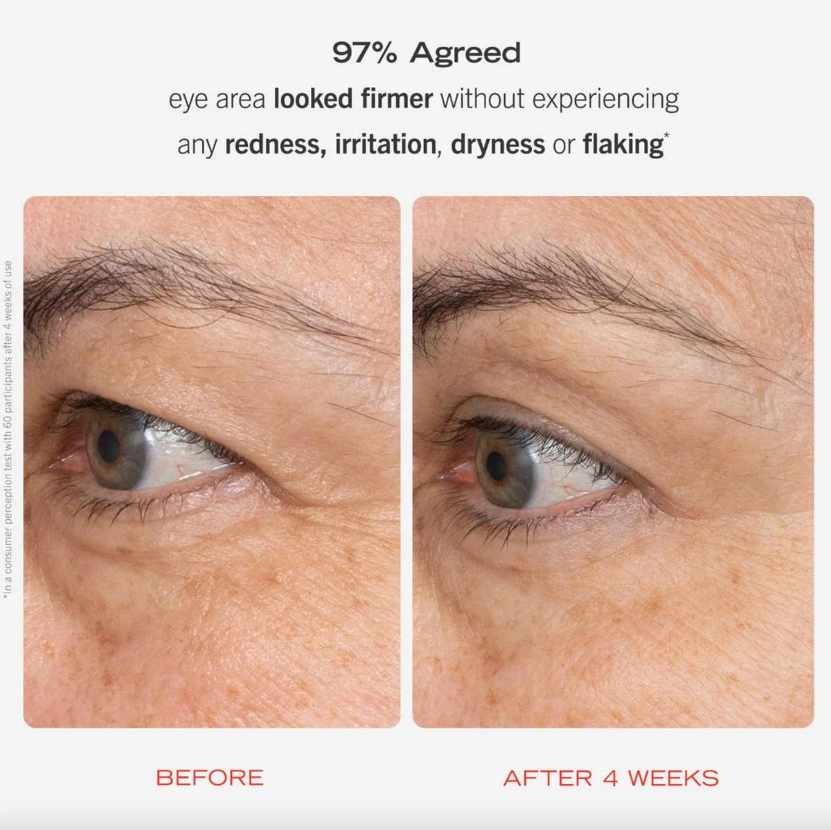 First aid beauty retinol eye cream discount