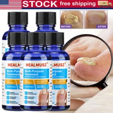 HEALMUSZ Multi-Purpose Treatment for Toenail & Fingernails Repair Solution 30ml