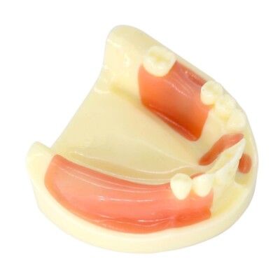  Dental absence of different teeth implant teeth model can exercise cut implant