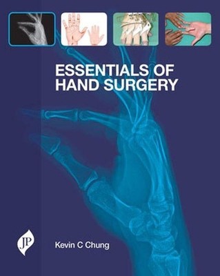 Essentials of Hand Surgery - 9781907816321