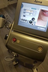 Alma Soprano ICE Laser Machine W/ Nir & Diode Handpieces.