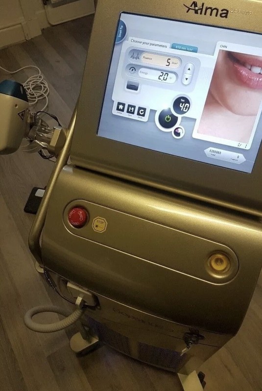 Alma Soprano ICE Laser Machine W/ Nir & Diode Handpieces.
