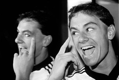 1982 New Zealand World Cup star Wynton Rufer shows off his scars h- Old Photo