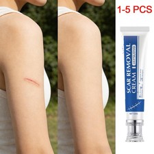 1-5X SCAR REMOVAL CREAM Skin Repair Scar Remover Fade Stretch-MarkAcne Treatment