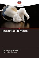 Impaction Dentaire Tsvetan Tsvetanov