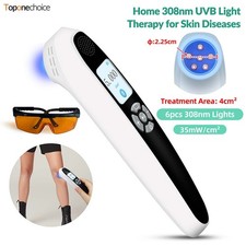 308nm UVB Light Therapy Device Handheld 6 Diodes Portable for Skin Care Home Use