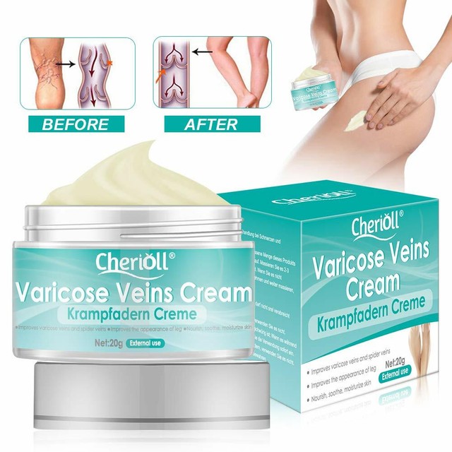 Varicose Veins Cream, Varicose Vein & Soothing Leg Cream, Natural