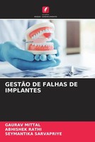 GestÃO DE Falhas DE Implantes Gaurav Mittal (U. A.) Taschenbuch Portugiesisch