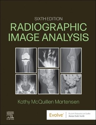 Radiographic Image Analysis McQuillen-Martensen Hardback Saunders 6e