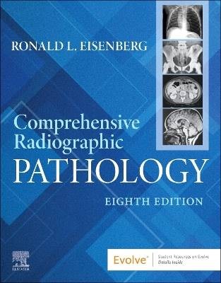 Comprehensive Radiographic Pathology, Ronald L. Ei