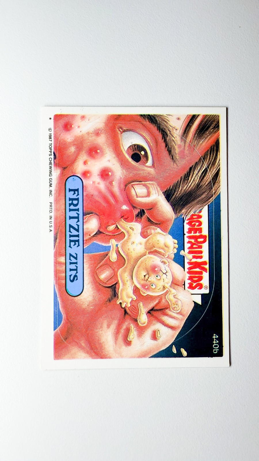 FRITZIE Zits #440b 1987 Garbage Pail Kids trading card — raw and PSA graded price guide