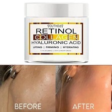 Dark Skin Whitening Dark spot Brightening Bleaching Lightening Face body Cream