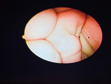 Pentax FNL-10RP3 Endoscope