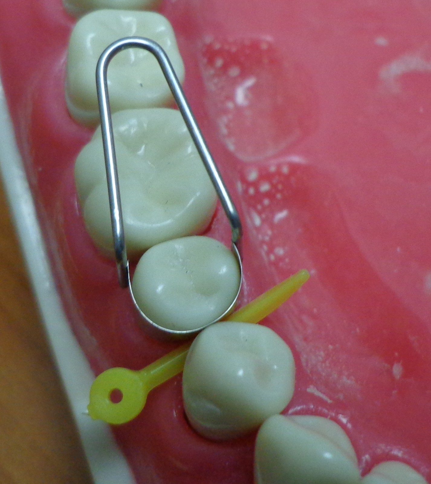 Dental Matrix Bands / The U Dental Bands .Primary Molar Bands eBay