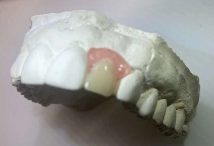 ALETA DENTAL FLEXIBLE Foto 2 de 4