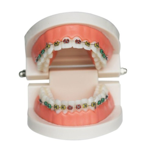 NEWFake Braces Kids Fake Braces Lip Protector Colorful Braces Wire Teeth Cosplay - Picture 2 of 8