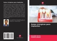 Guias CirúRgicas Para Implantes Saurabh Verma