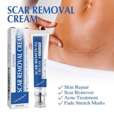 Scar Cream Face Body Scar Cream Scar Acne Stretch Mark Removal Ointment