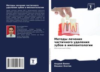 Anuraj Viqqn (U. A.) | Metody Lecheniq Chastichnogo Udaleniq Zubow W...