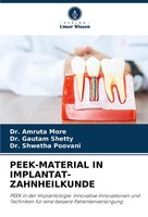 PEEK-MATERIAL In IMPLANTAT-ZAHNHEILKUNDE Amruta More