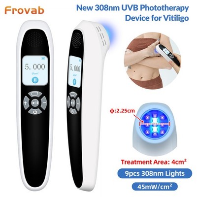 45mW/cm² Portable 308nm UVB Light Therapy for Skin Healing & Tone Balancin Home