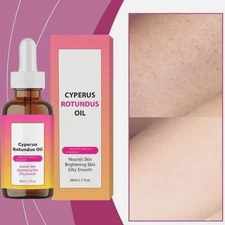 Cyperus Rotundus Oil For Hair Removal 60ml Natural Cyperus Rotundus Oil 