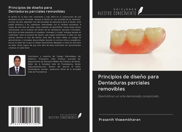 Principios De DiseñO Para Dentaduras Parciales Removibles Prasanth Viswambharan-image
