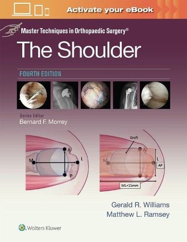 Master Techniques in Orthopaedic Surgery: The Shoulder: Print... - 9781975217969