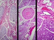Mammalian Salivary Glands Composite; Showing Sublingual, Submaxillary, and