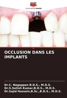 M. D. S. B. D. S. (U. A.) | Occlusion Dans LES Implants | Taschenbuch (2021)