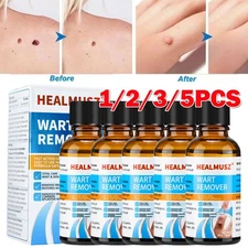 5/3x Wart Remover Liquid Skin Tag Mole Remover Eliminate Foot Corn Warts Unisex