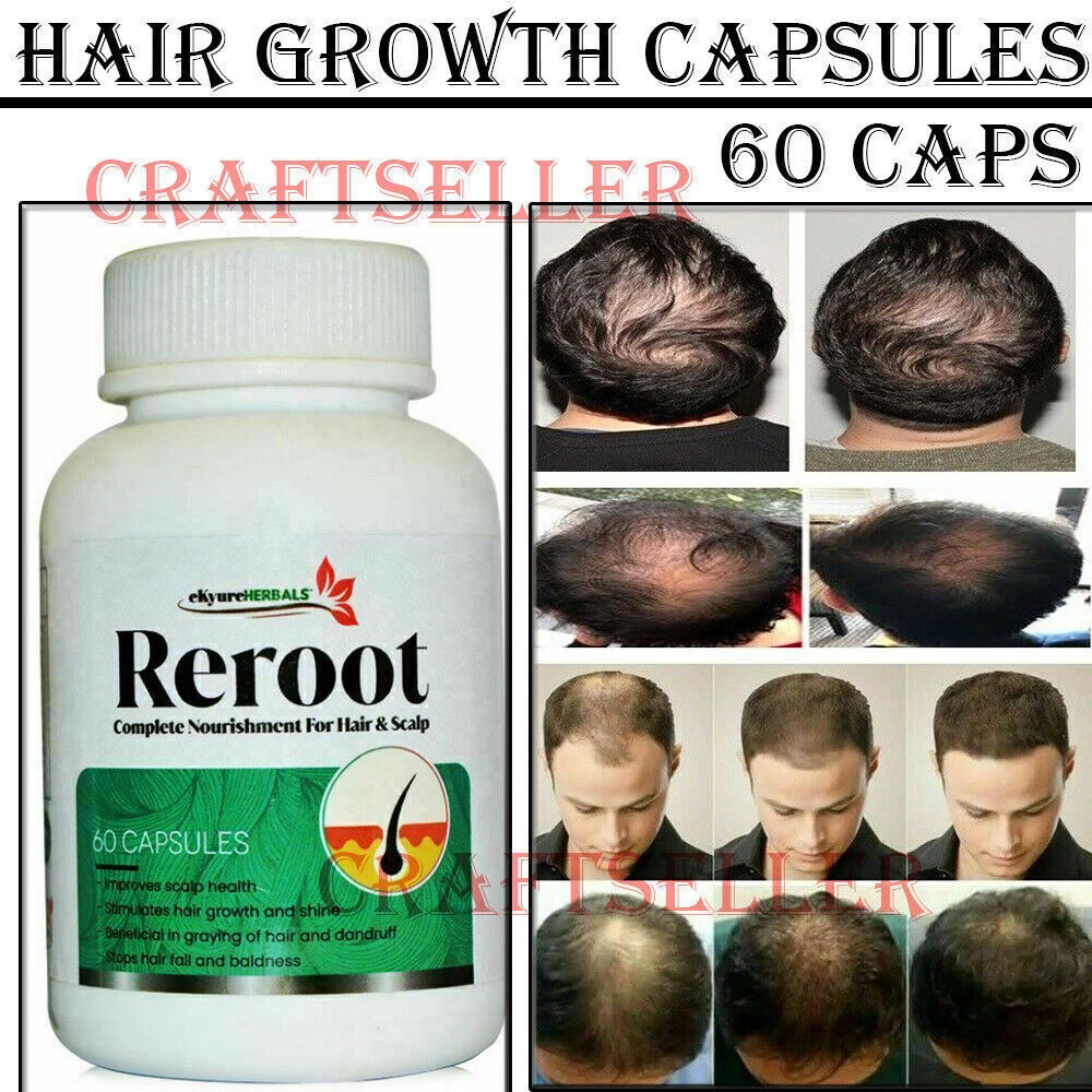 Discover 148+ hair growth capsules latest camera.edu.vn