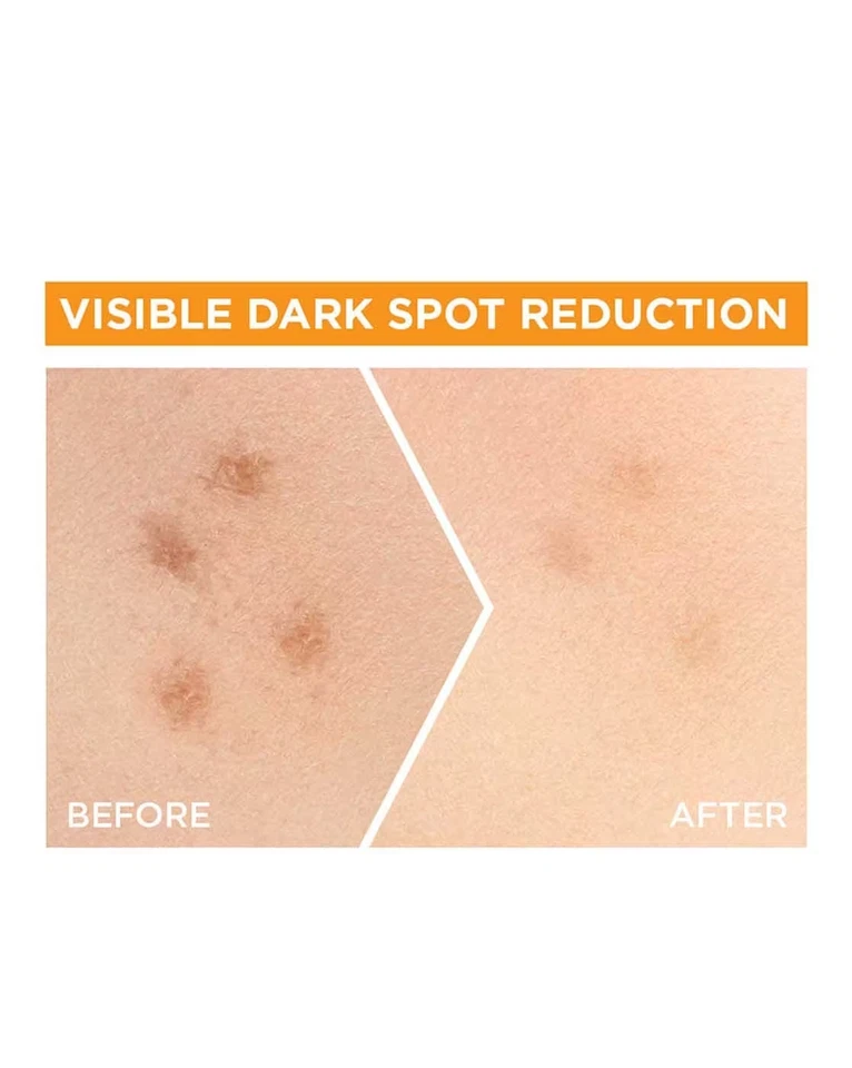 Garnier Bright Complete VITAMINA C 30X Booster Suero Facial 30 ml II ' Foto 4 de 4