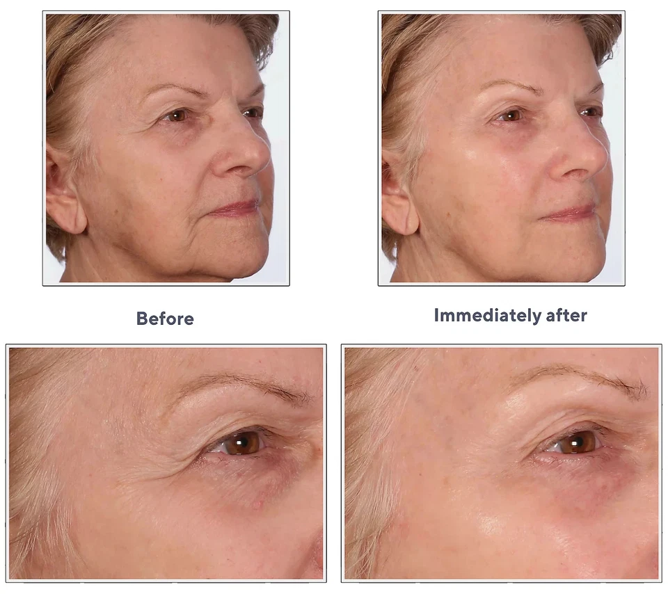 Serious Skincare Insta-Tox Suero Suavizante de Arrugas 1.42 OZ/42ml Nuevo SELLADO Foto 3 de 4