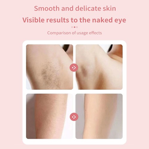 2 in 1 Dual Head Electric Lady Waterproof Shaver Razor for Women Private Area - Picture 14 of 16