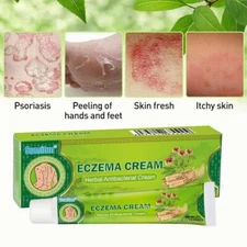 Sumifun Eczema Cream Herbal Antibacterial Ointment 20g External Use