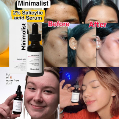 Minimalist Anti-Acne 2% Salicylic Acid Face Serum Reduces Blackheads Excess Oil